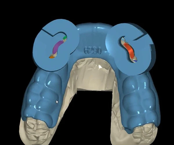 Diseño de Sonrisa Argadent